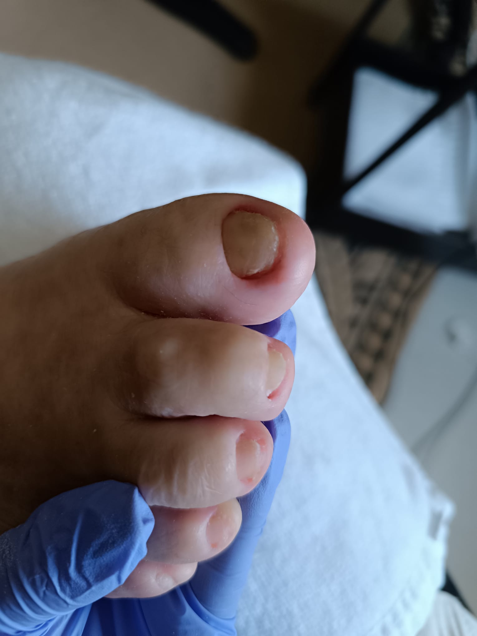 Pedicure medical